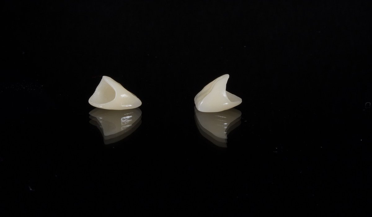 How Smoking Affects Dental Implant Success Rates