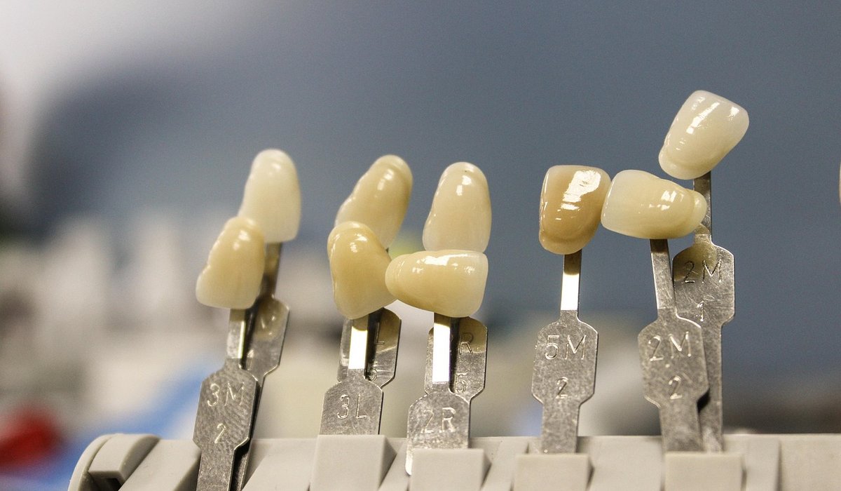 Understanding Sinus Lifts for Upper Jaw Implants