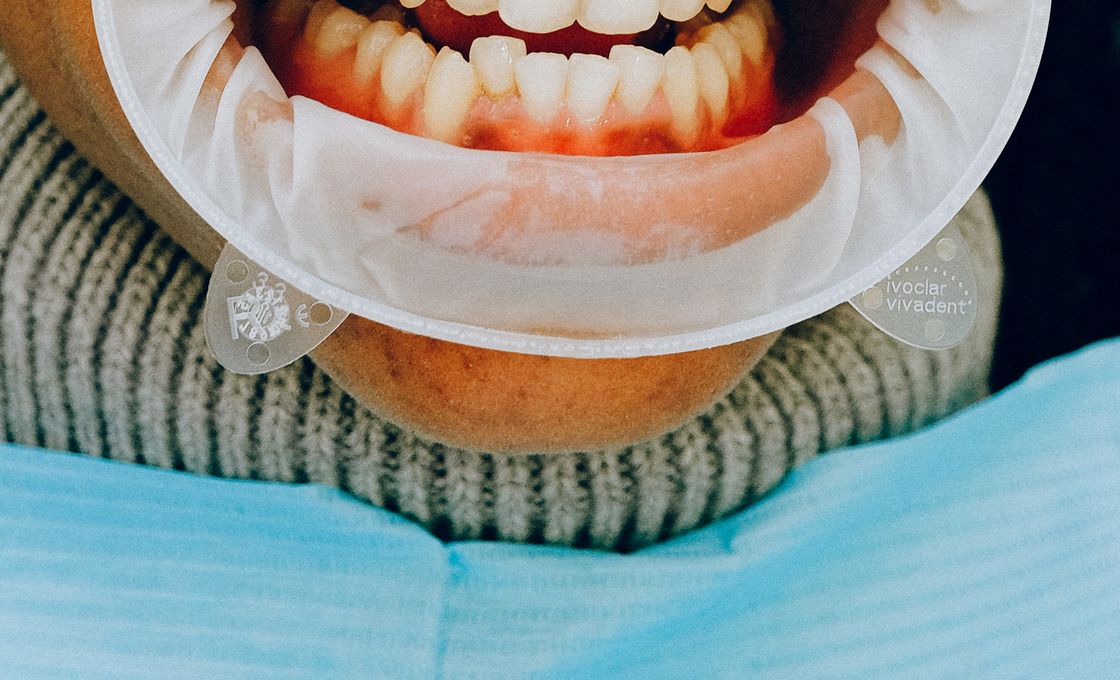 Oral Implants
