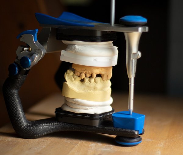 Oral Implants